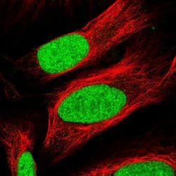 TAF13 Antibody, Novus Biologicals:Antibodies:Primary Antibodies